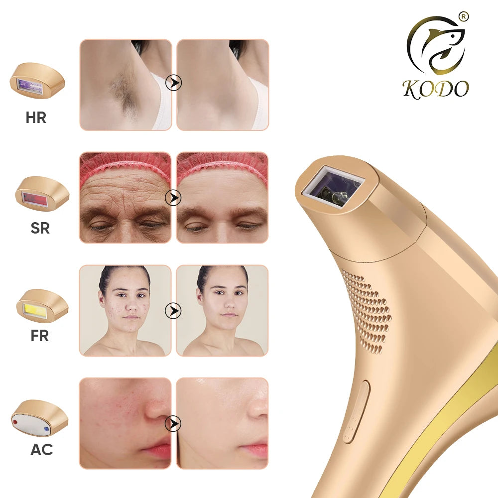KODO 2025 Épilateur laser 4 en 1 pour le visage et le corps, personnalisation haut de gamme, IPL permanent, indolore